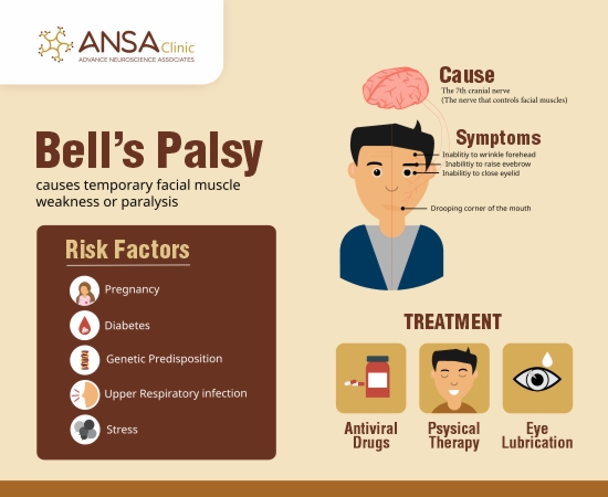 Bell's palsy Cause, Symptoms